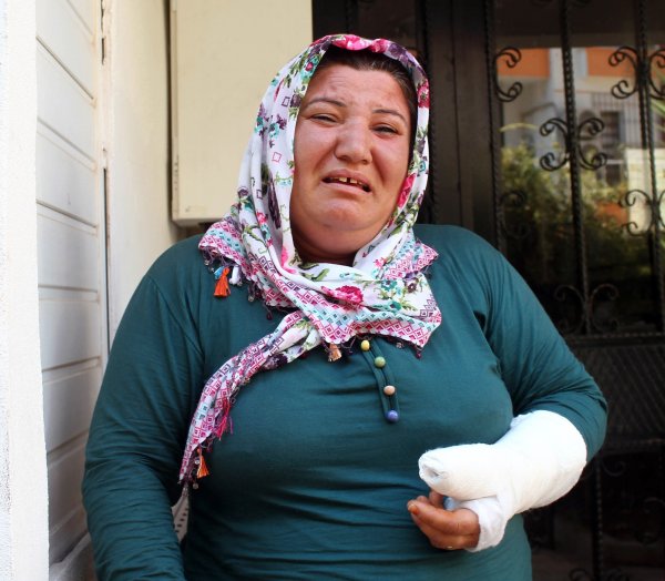 İşitme Engelli Kadın'a Saldırı! Kolunu Kırdı