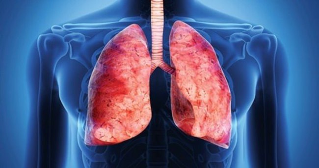Akciğer Kanserine Yakalanan Kişi Neler Yapmalı