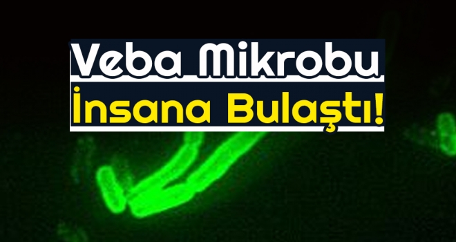 Milletvekili Zeybek: Veba Mikrobu İnsana Bulaştı!