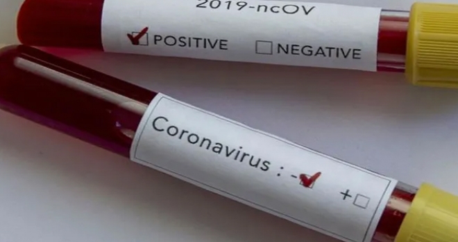 Koronavirüsün akciğerden başka bir organı daha etkilediği ortaya çıktı