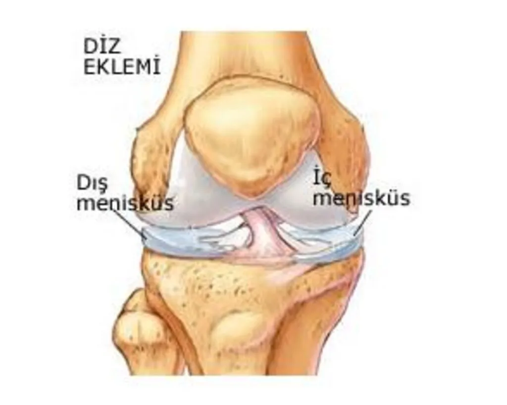 Menisküs Yırtığı Nedir Belirtileri Nelerdir Tedavi Yöntemleri Nasıldır