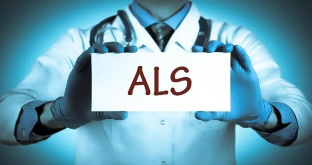 ALS Hastalığı nedir? ALS Nedir, belirtileri, tanımı, tedavi süreci