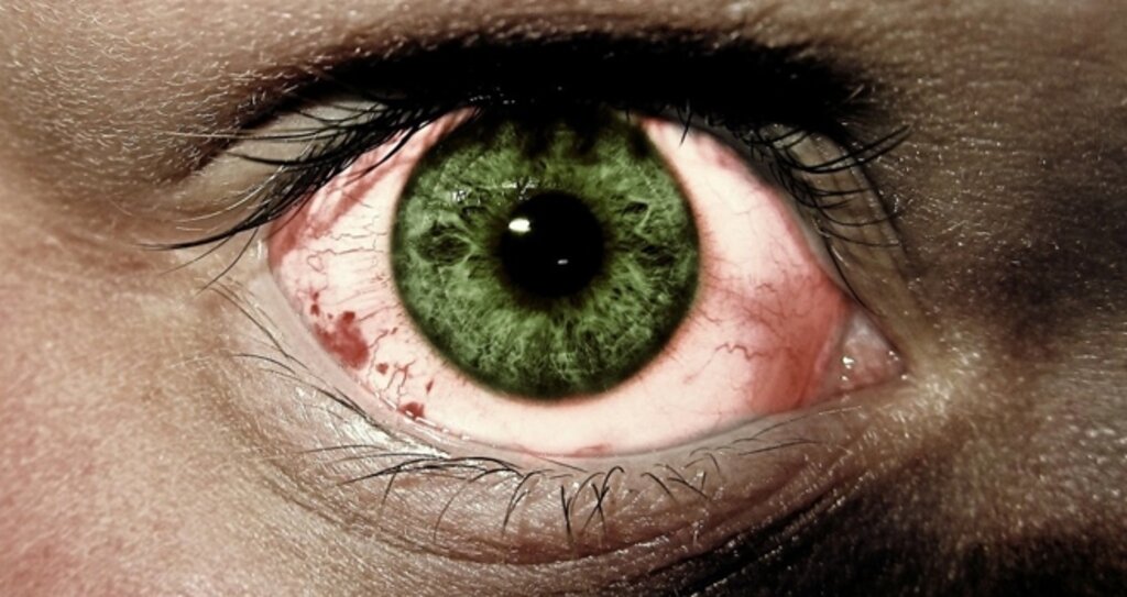 Yaz Aylarında Bu Enfeksiyonlara Dikkat!