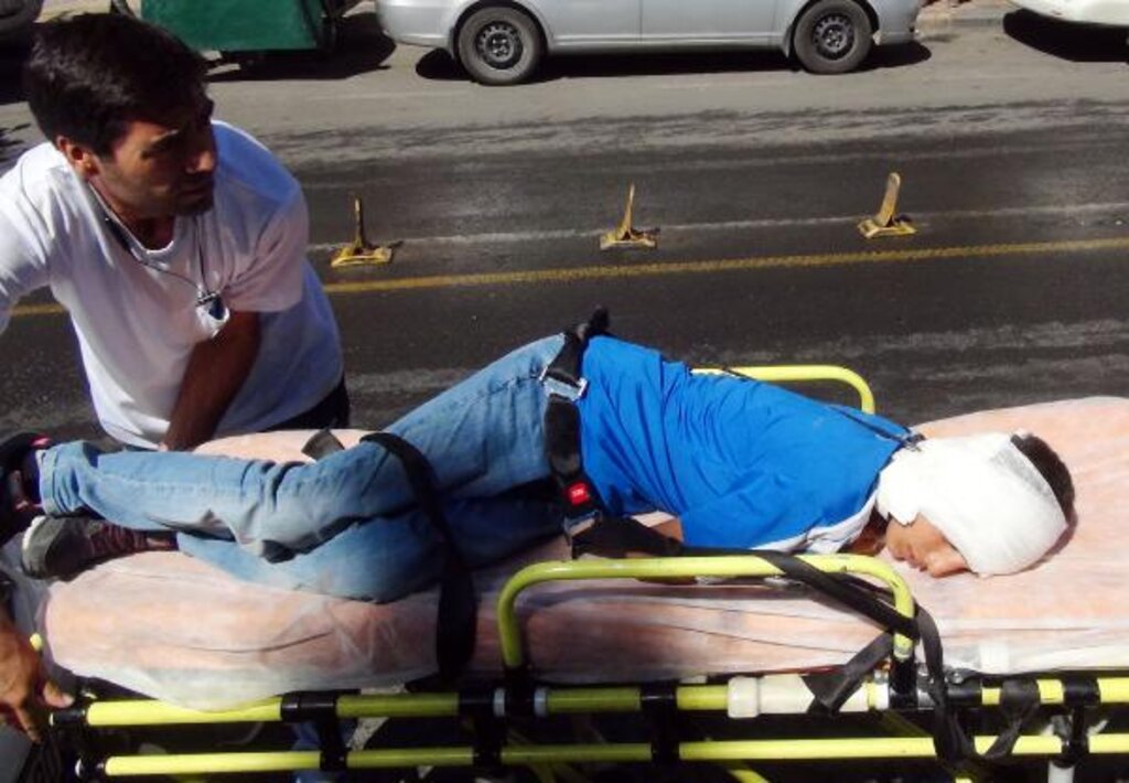 Şanlıurfa'da Bir Çocuk Kardeşinin Kulağına Şiş Sapladı haberi