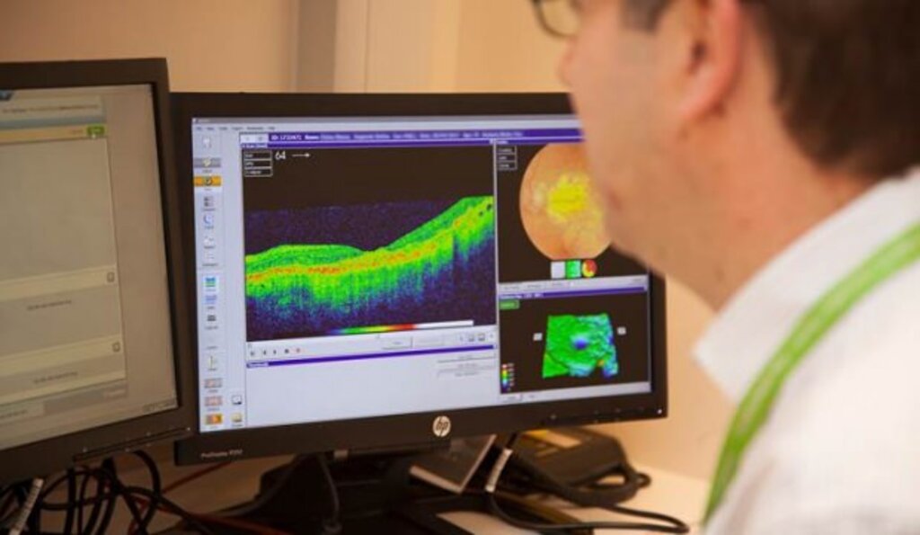 Geliştirilen Yapay Zeka Uzman Doktor Gibi Göz Hastalıklarını Teşhis Ediyor! haberi