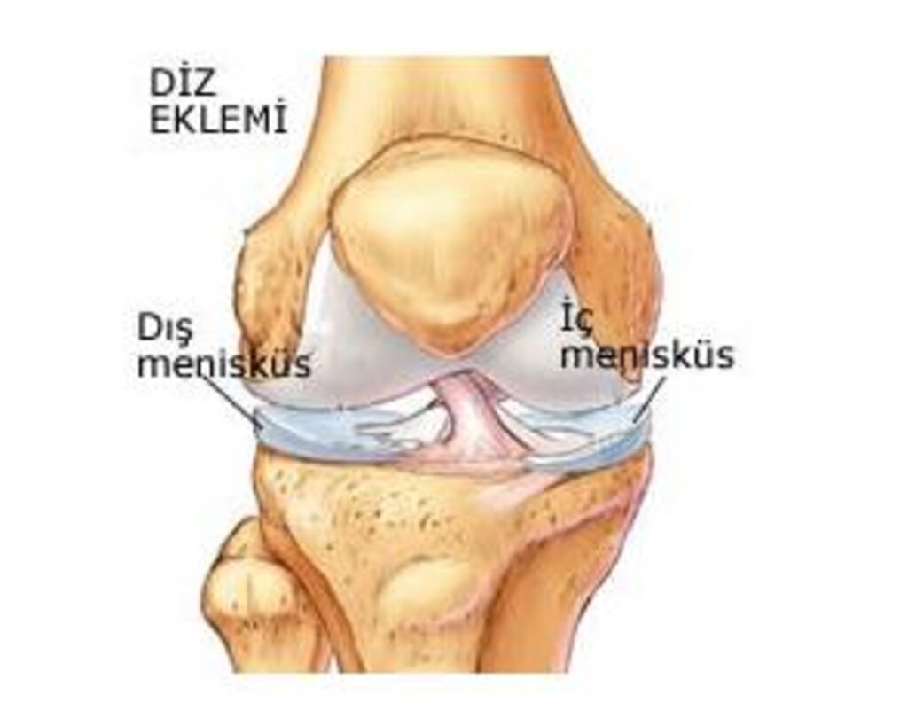 Menisküs Yırtığı Nedir Belirtileri Nelerdir Tedavi Yöntemleri Nasıldır haberi
