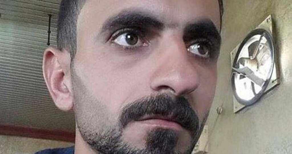 Burun Estetiği İçin Masaya Yattı Komaya Girip Hayatını Kaybetti! haberi