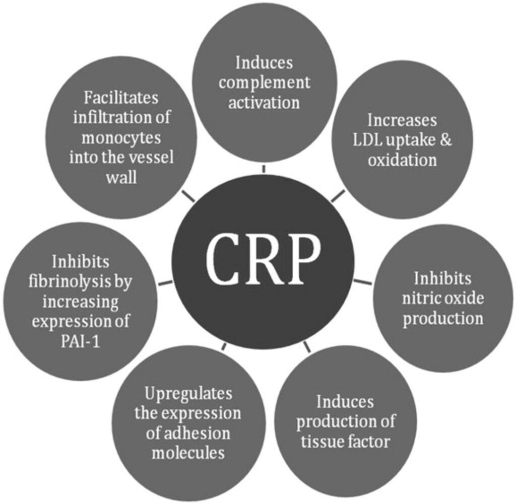 CRP Nedir ve Hangi Hastalığın Tetikçisidir haberi