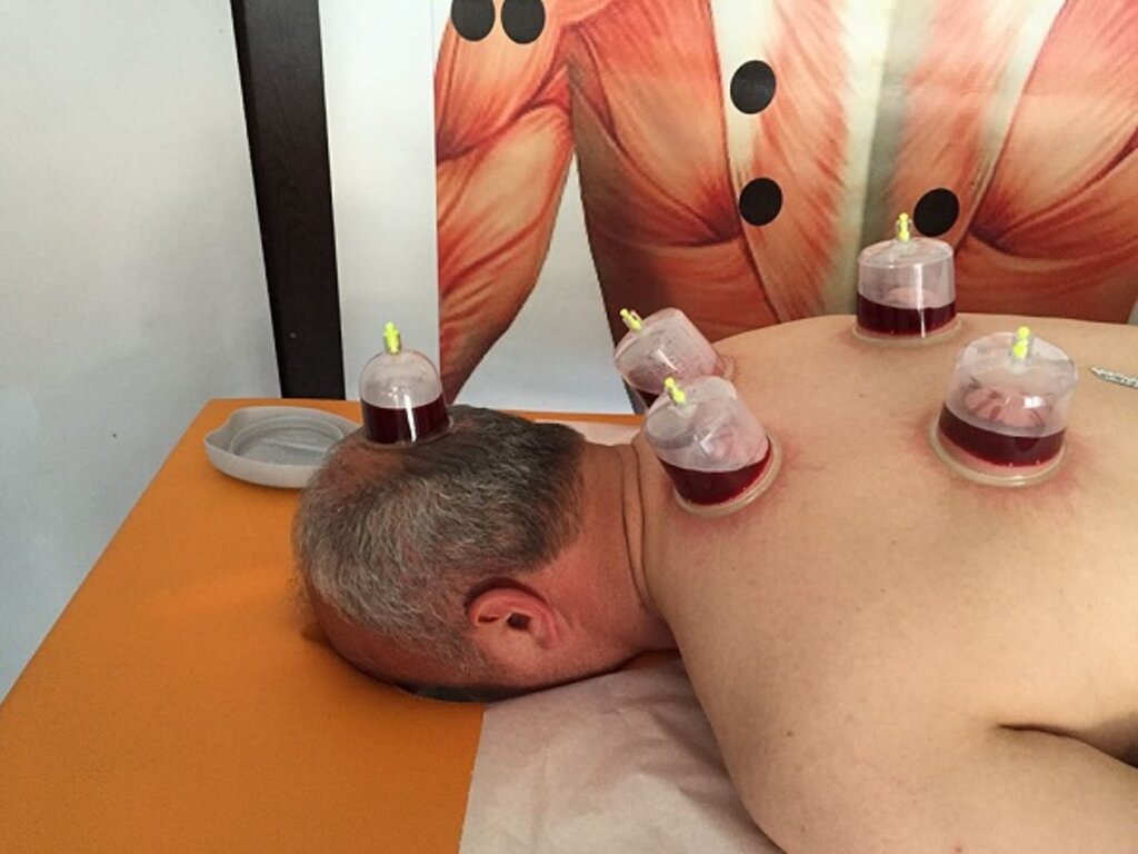 Hacamat Hakkında Merak Ettiğiniz Ne Varsa Burda! haberi